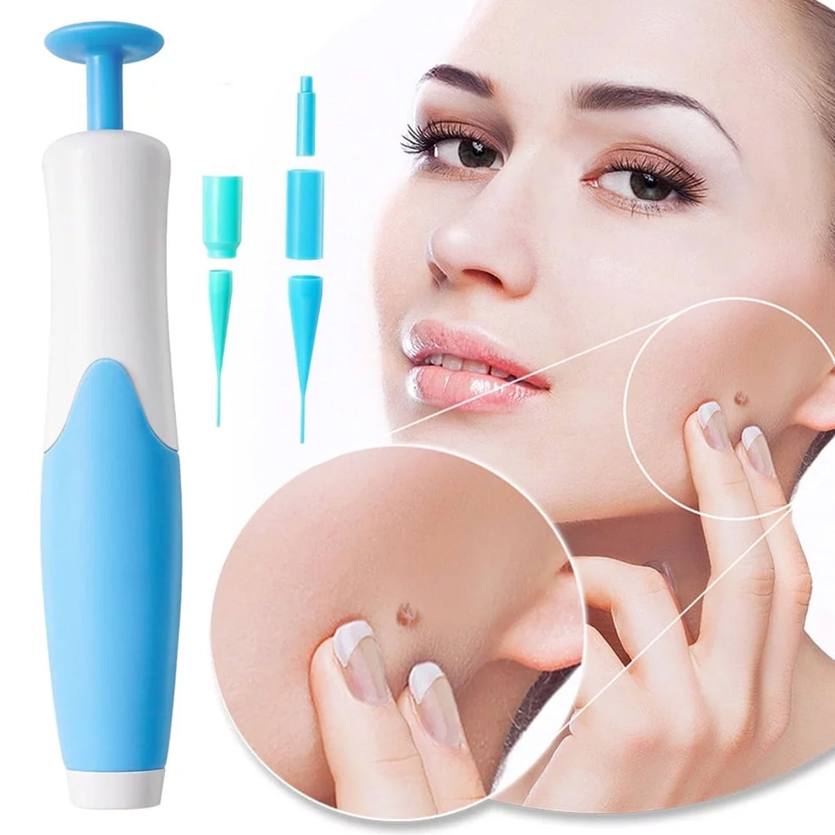 Skin Tag Remover