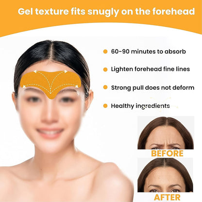 Forehead Wrinkle Smoothing Patches