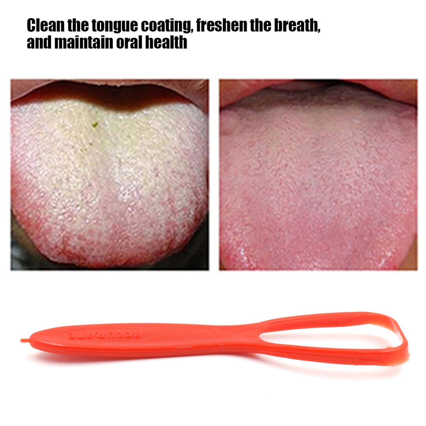Professional Tongue Cleaner