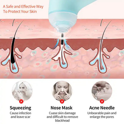 Handheld Vacuum Pore Cleaner