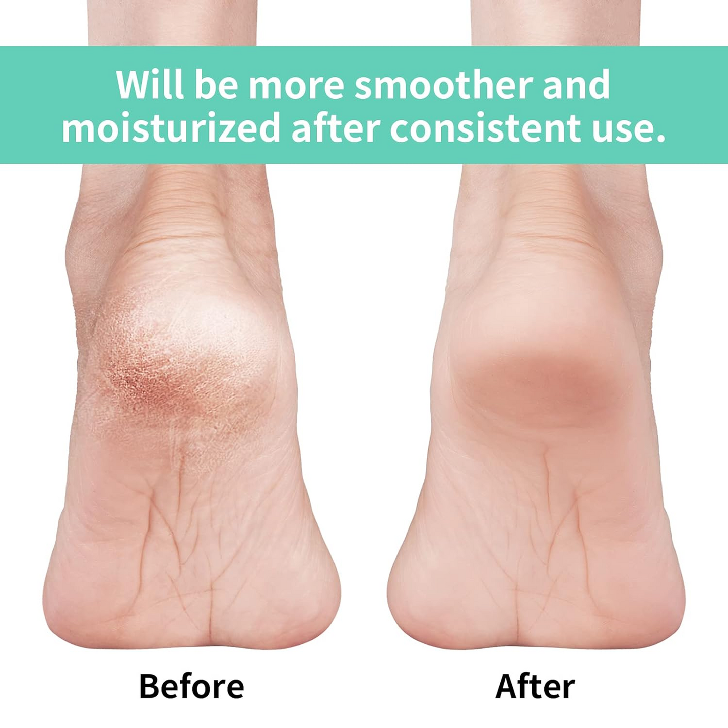 Anti Crack Silicon Gel Heel Moisturizing Socks