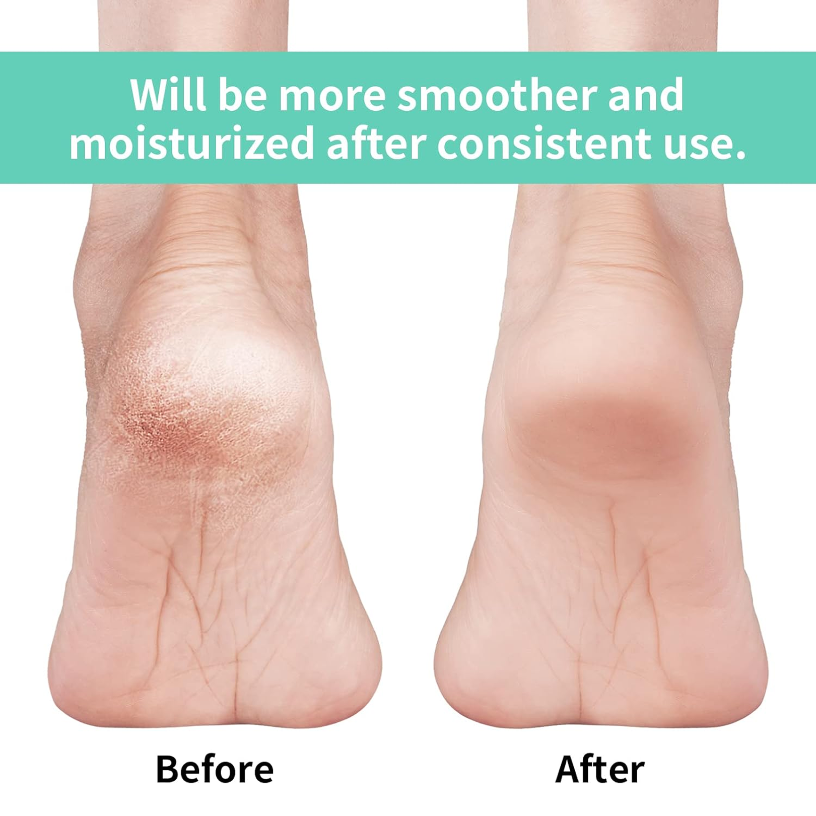 Anti Crack Silicon Gel Heel Moisturizing Socks